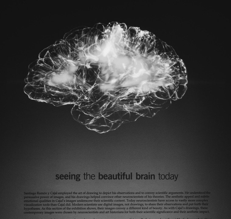 Learning Sciences Mythbuster: We are not left-brained (logical) or right-brained (creative)